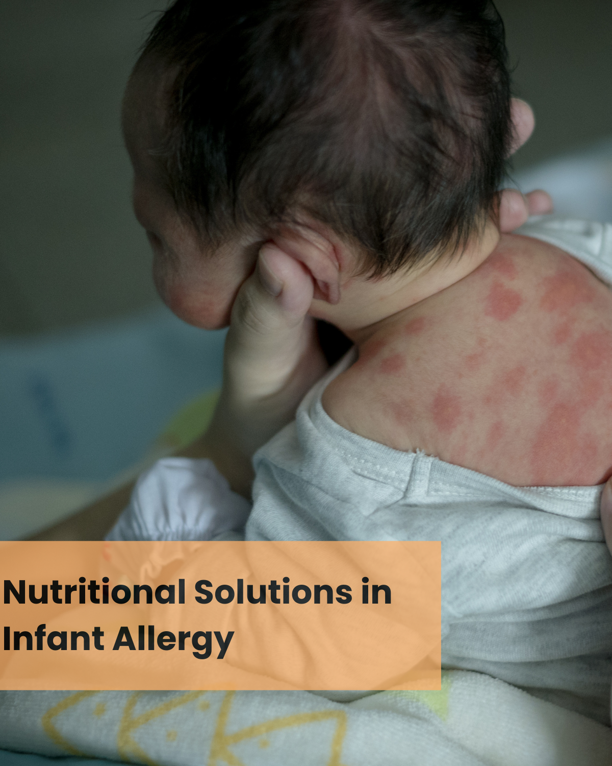 Grant call - Nutritional Solutions in Infant Allergy