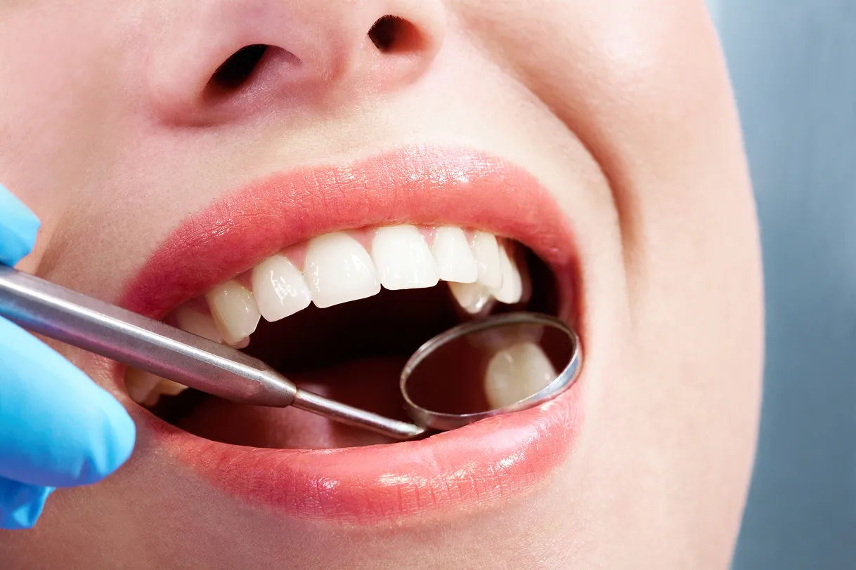 Close-up of a dental examination with a mouth mirror and probe inside a patient's open mouth.