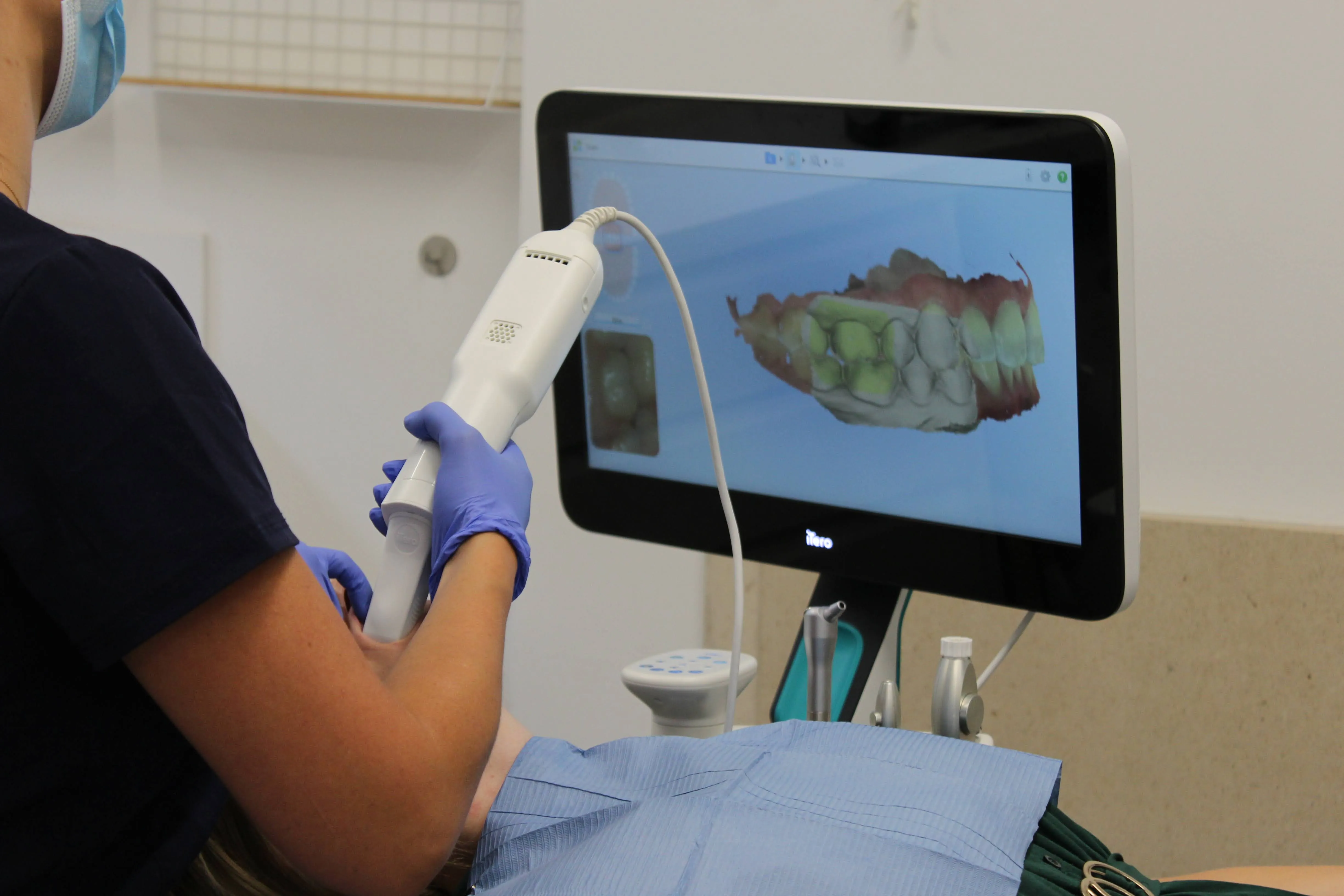 Dental professional wearing gloves using an intraoral scanner to capture 3D images of a patient's teeth displayed on a monitor.