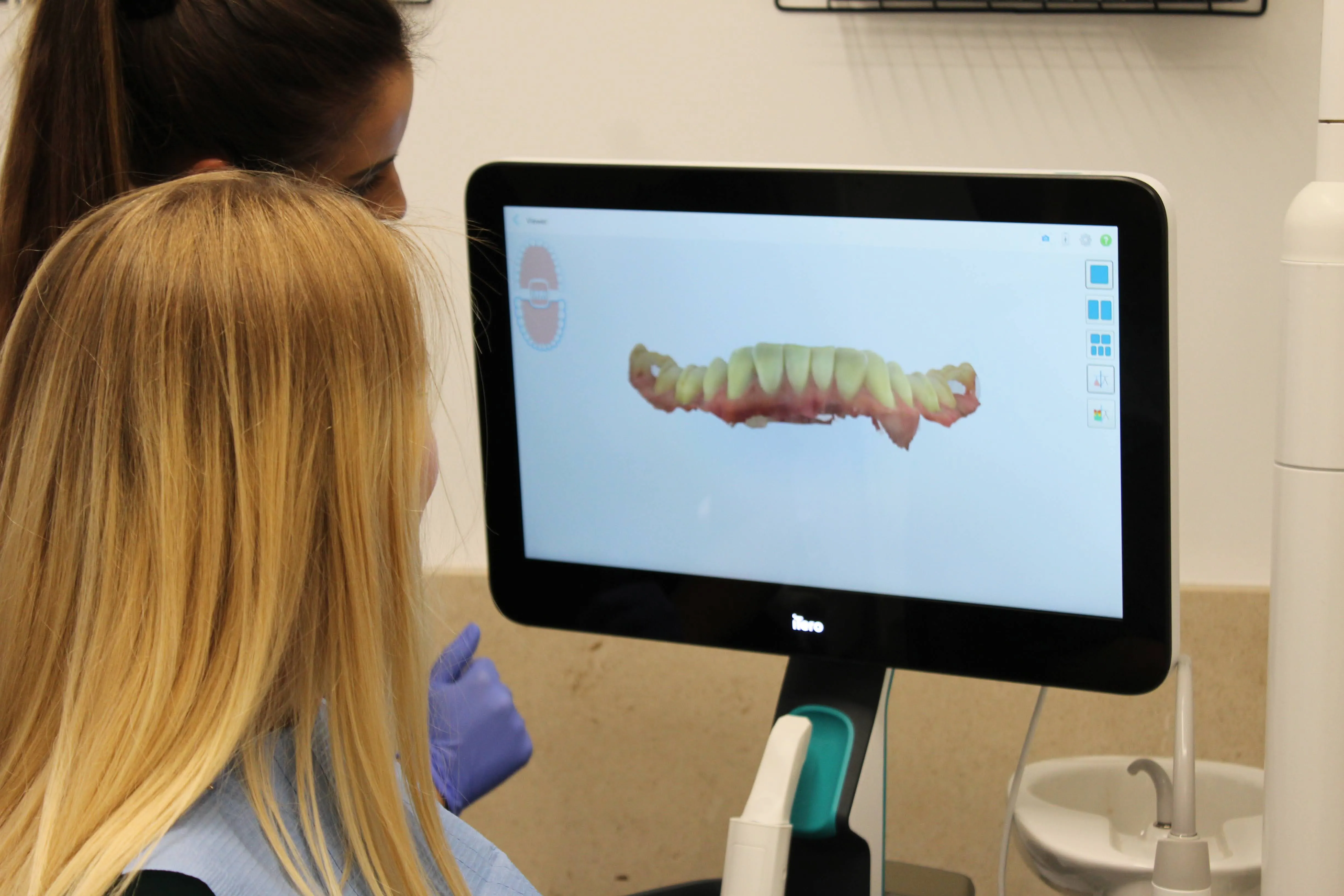 Two women observing a digital 3D dental model of upper teeth on a screen in a dental office.
