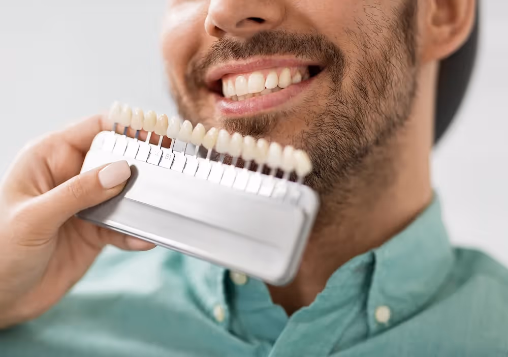 Man smiling with a dental shade guide held next to his teeth for color comparison.