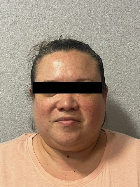 A woman with a black strip on her forehead