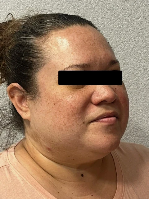 A woman with a black spot on her forehead