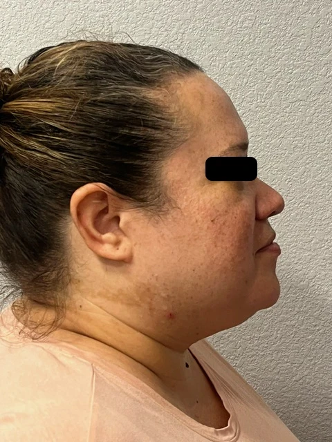 A woman with a black marker on her forehead