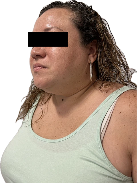 A woman with a black square on her forehead