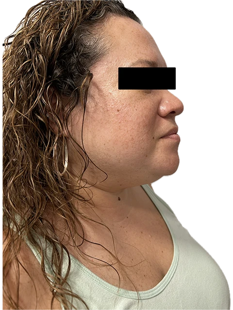 A woman with long hair has a piece of black tape on her face