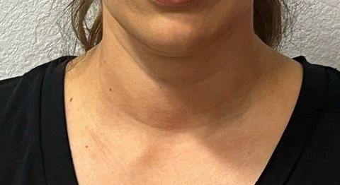 A close up of a woman's neck and chest