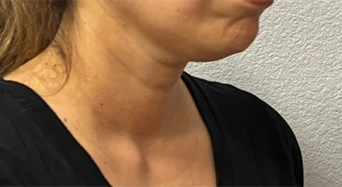 A close up of a woman's face and neck