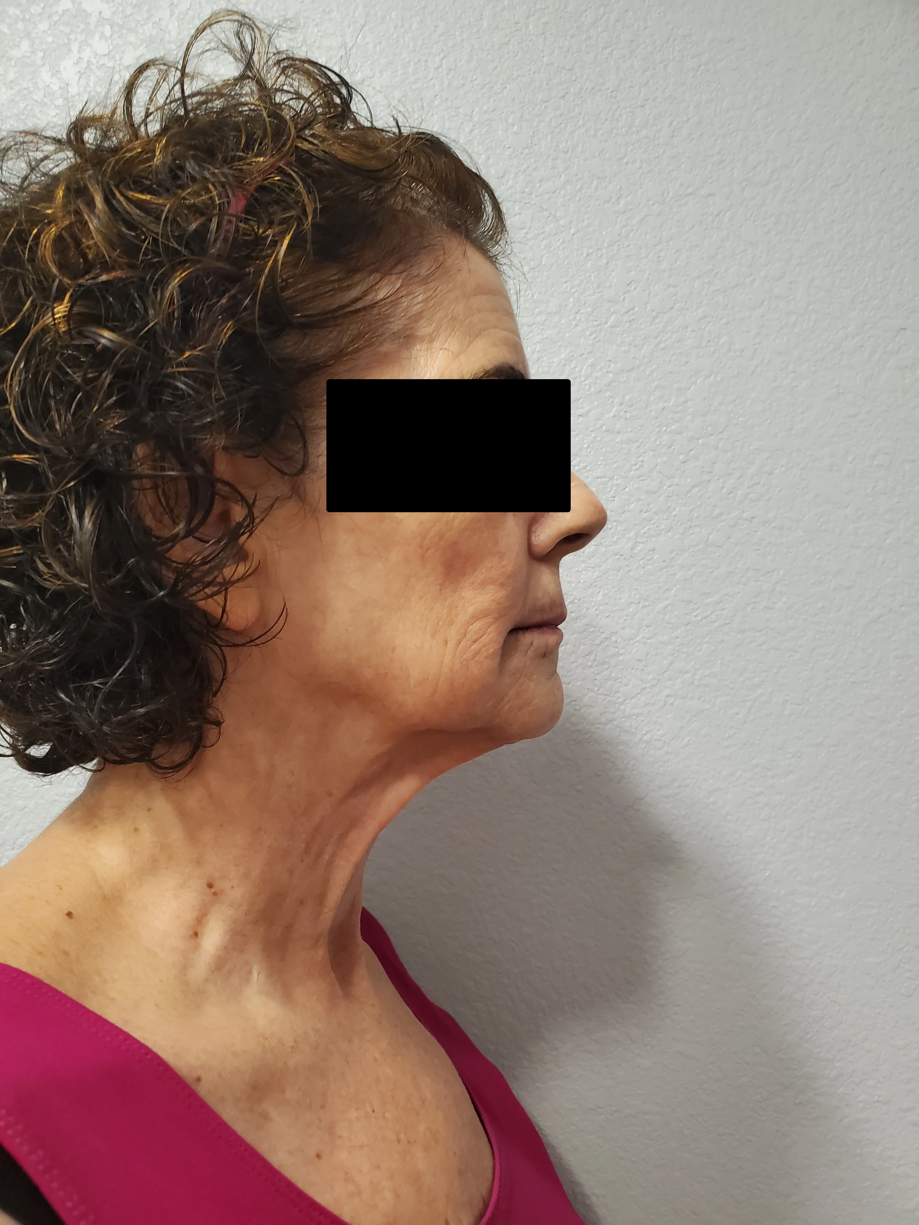 A woman with curly hair and a black square on her face