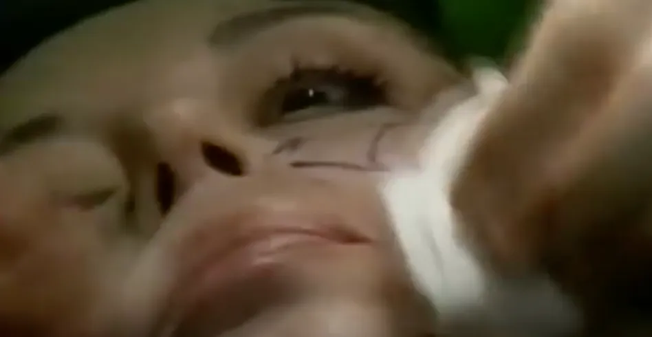 Closeup photo still of woman's face lying down with nostrils and eyes pointing at the camera, erasing facial markings, artwork by French carnal artist ORLAN, la reincarnation de sainte omnipresence.