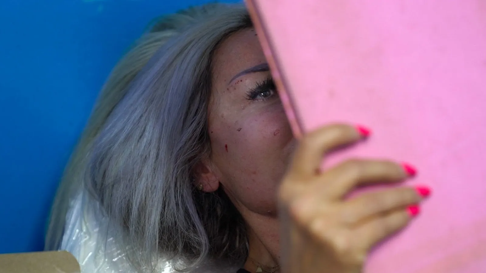 Botox customer at an aesthetician's office waiting for treatment, beirut lebanon postwar society and beauty standards, a frown gone mad, documentary by Omar Mismar, interviewed by gabriele di donfrancesco.