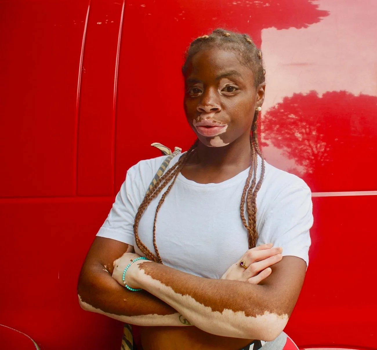 Against a bright red car, a person with vitiligo and braids poses with their arms crossed, slightly smiling as they look directly into the camera.