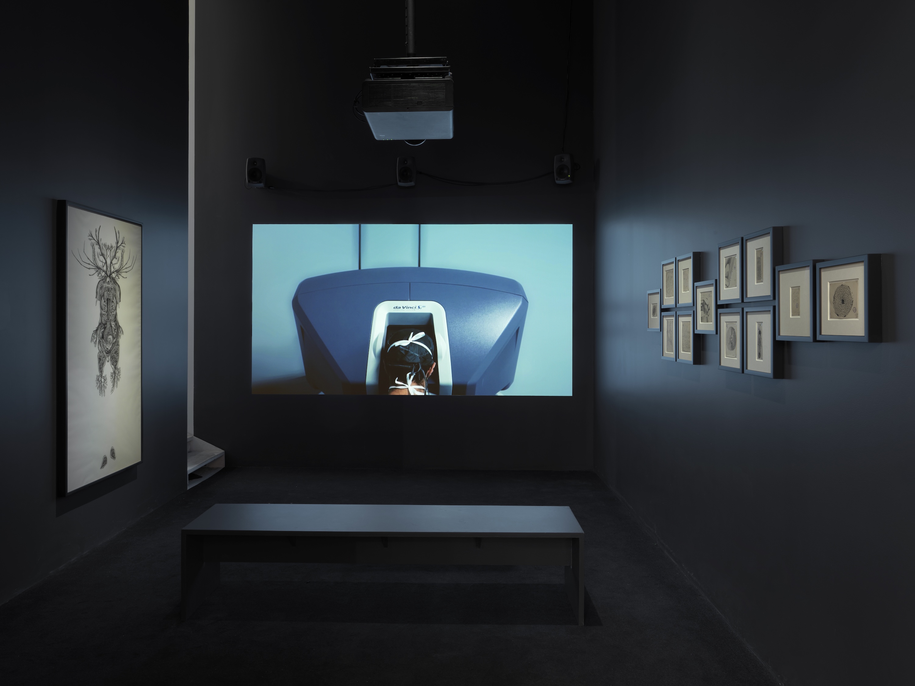 A darkened screening room with a projected film showing a person beneath a da Vinci surgical robot, flanked by anatomical drawings and circular botanical illustrations.