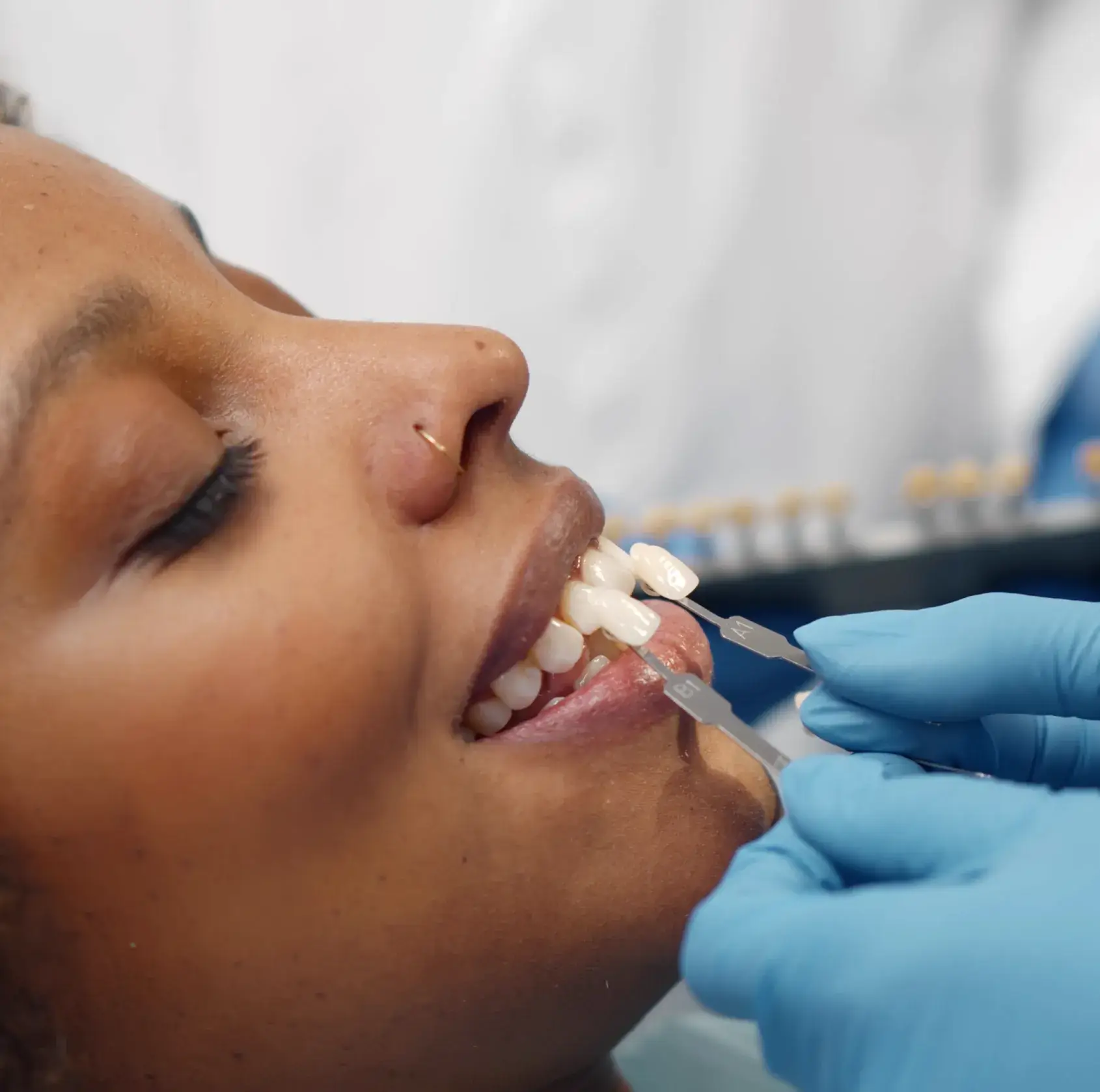 Dental professional wearing blue gloves holding tooth shade guides next to a smiling patient's teeth for color matching.