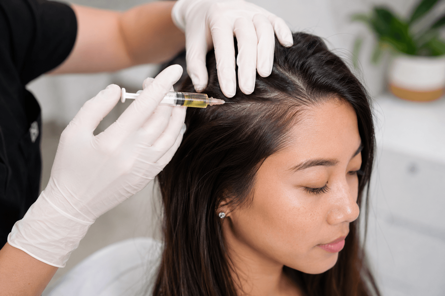 PRP treatment for hair loss in Honolulu Hawaii showing scalp injections for natural hair regrowth
