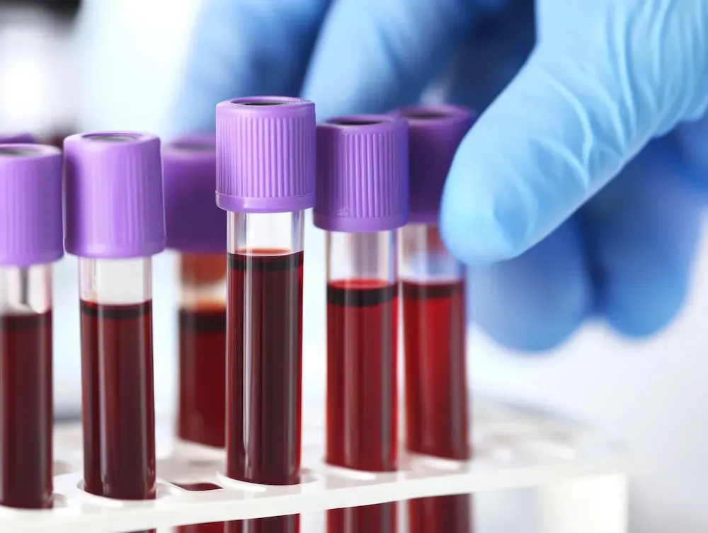 Bloodwork | Magnolia Functional Wellness