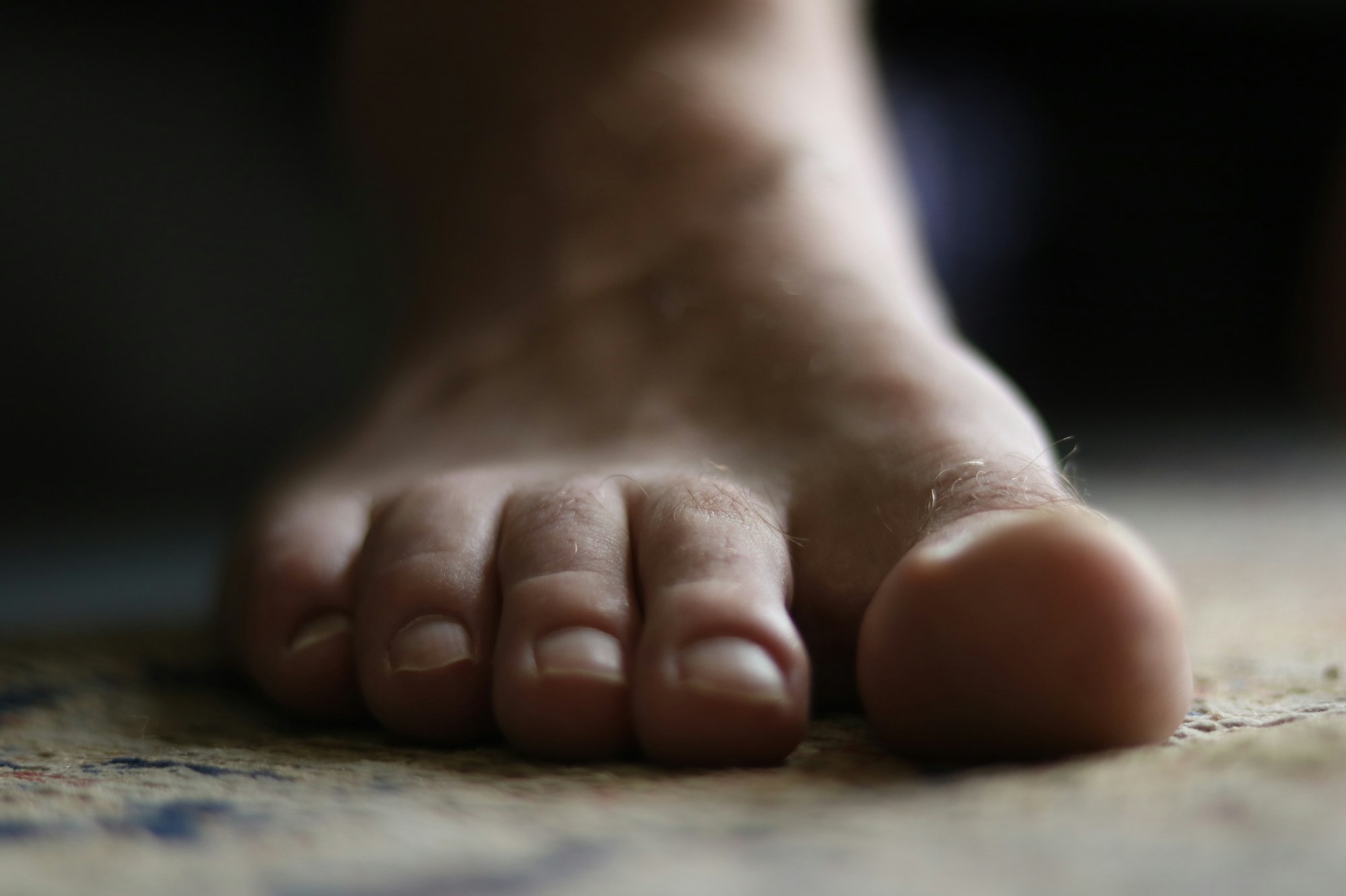 Heel Spurs and SoftWave Therapy | Southlake TX