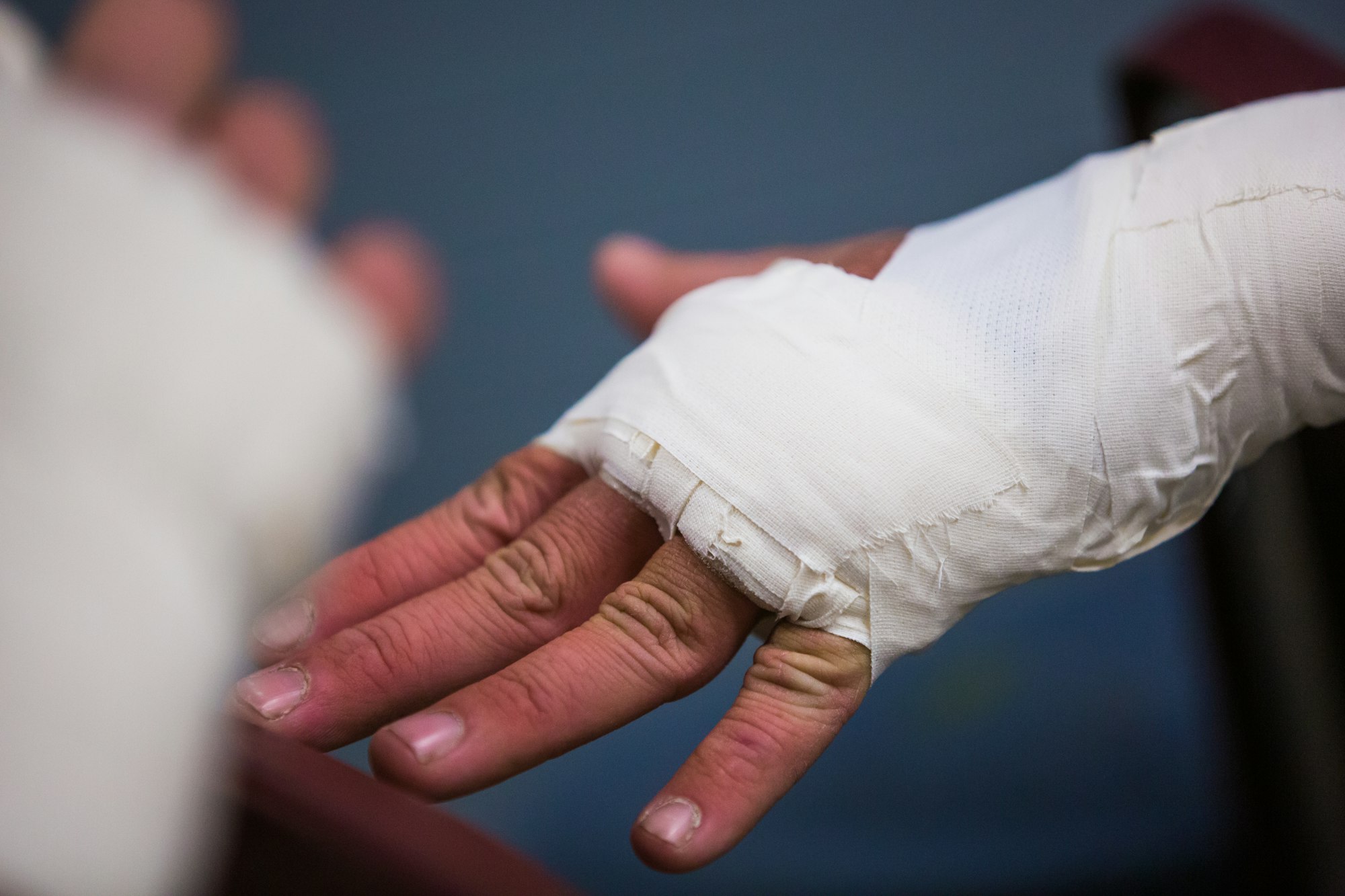 PRP for Wound Healing: What the Evidence Shows | Southlake