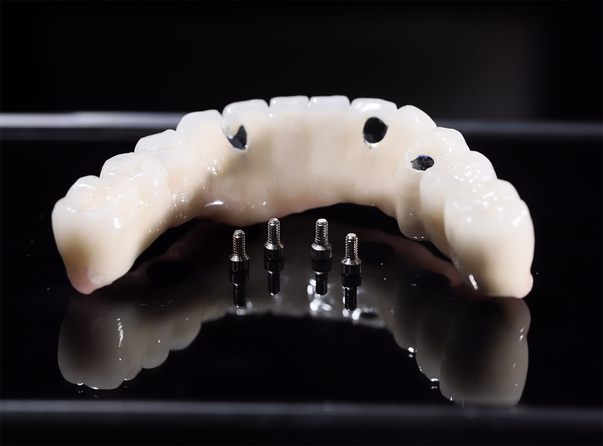 Dental implant bridge device with four metal screws on a reflective black surface.