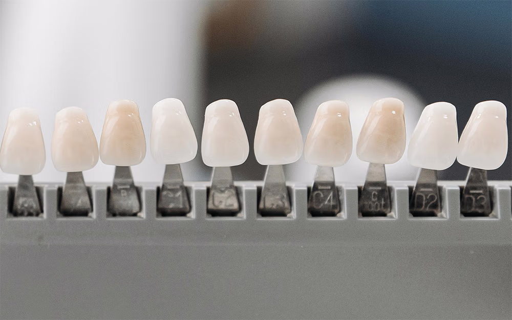 Dental shade guide with artificial teeth samples arranged in a row on a gray holder.