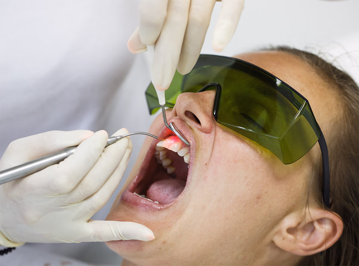 Dental professional wearing gloves performing laser treatment on a patient's upper front tooth while the patient wears protective green glasses.