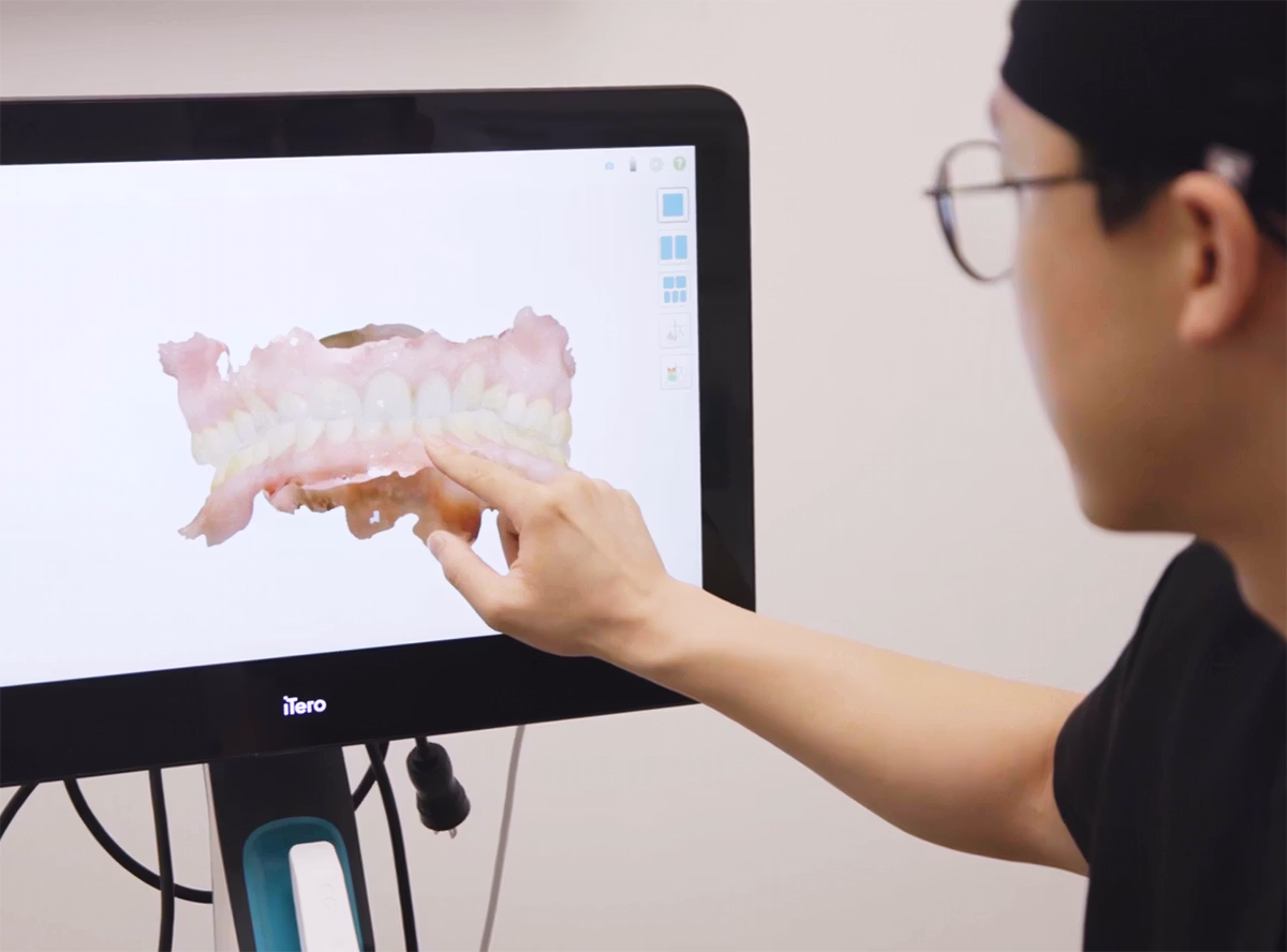 Dentist pointing at a 3D digital model of upper and lower teeth on a computer screen.
