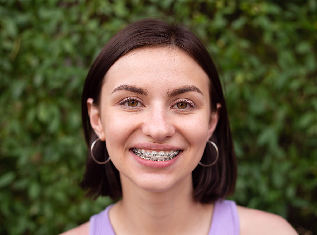 Smiling young woman with metal braces for tooth correction.