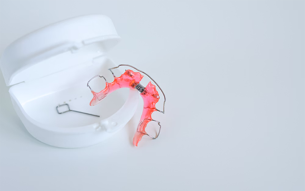 Pink orthodontic retainer with metal wire placed next to a white retainer case on a light surface.