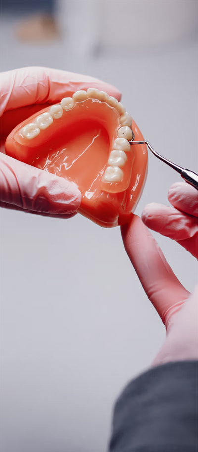 Dental assistant holding a model of the lower jaw to accurately fit dentures.