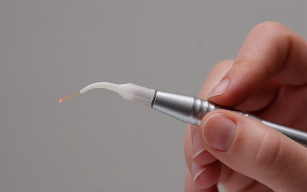 Hand holding a dental laser device with a small red light at the tip.