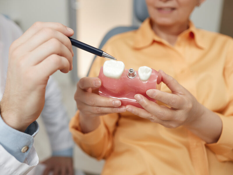 Dentista explicando con un modelo cómo se sujeta una prótesis sobre implantes