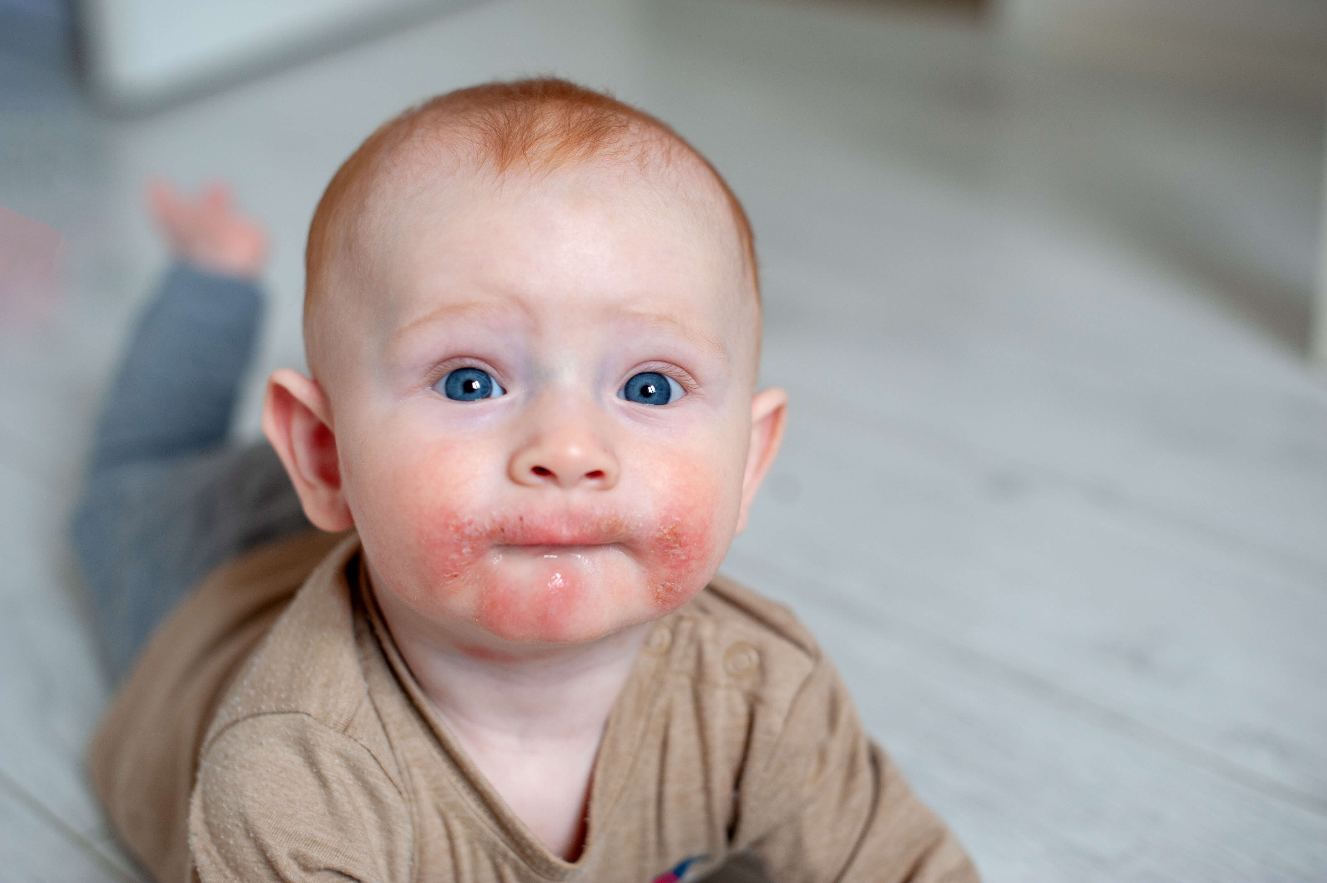 PREMIPLA: Impact of Prebiotics in Placenta Allergy Prevention