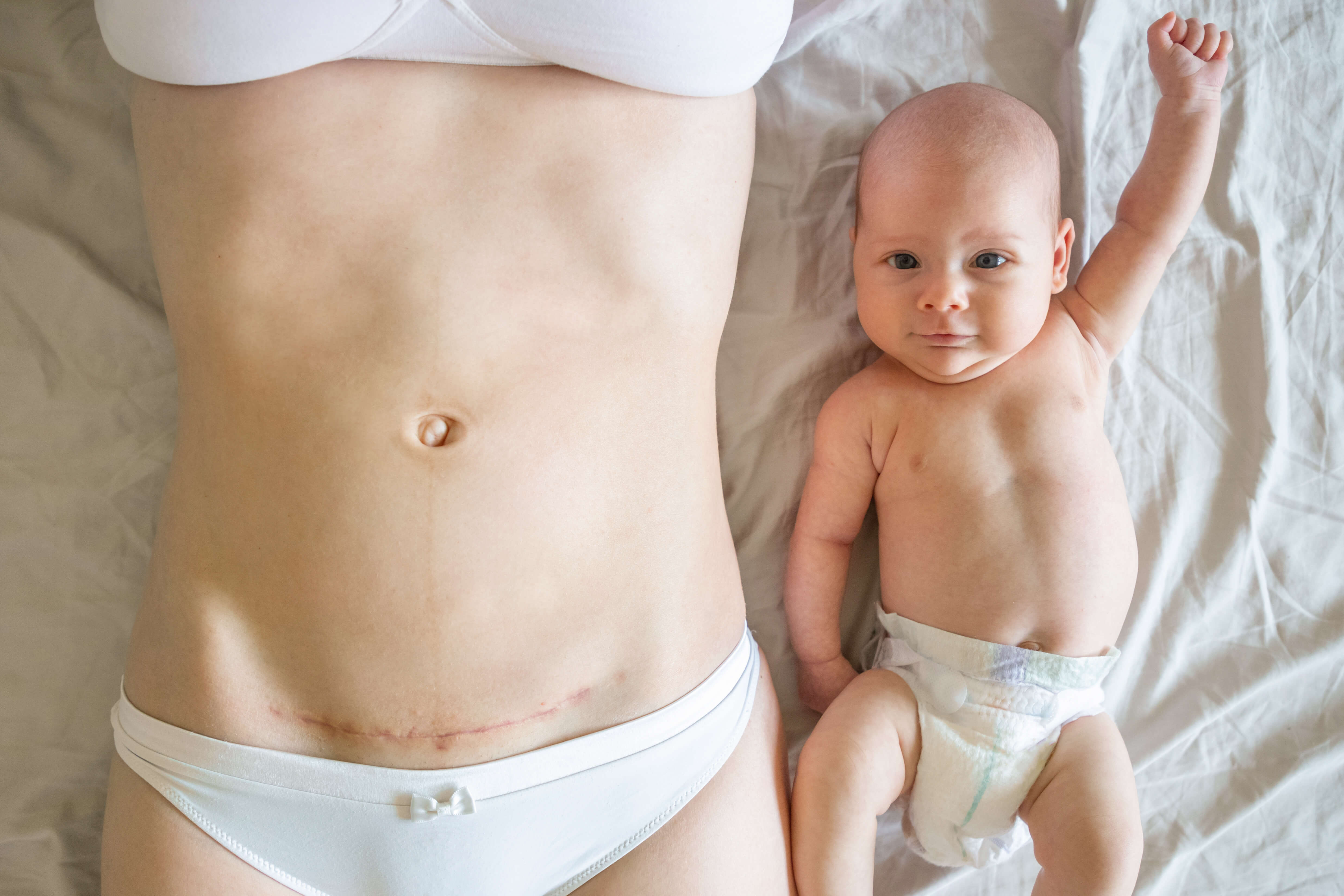 Perinatal Factors in Vertical Microbiota Transmission
