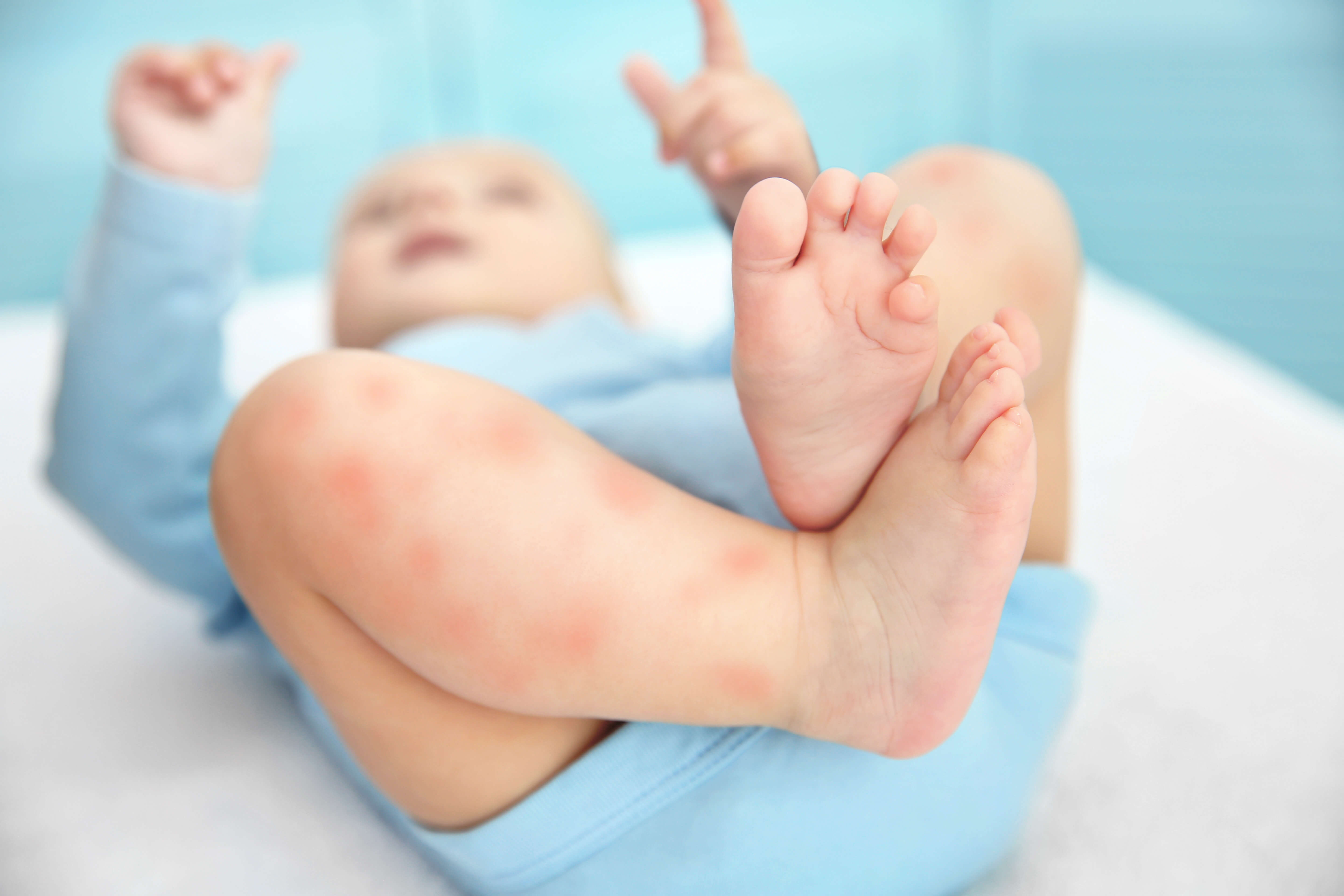 Does colonization of butyrate producers impact susceptibility to atopic dermatitis