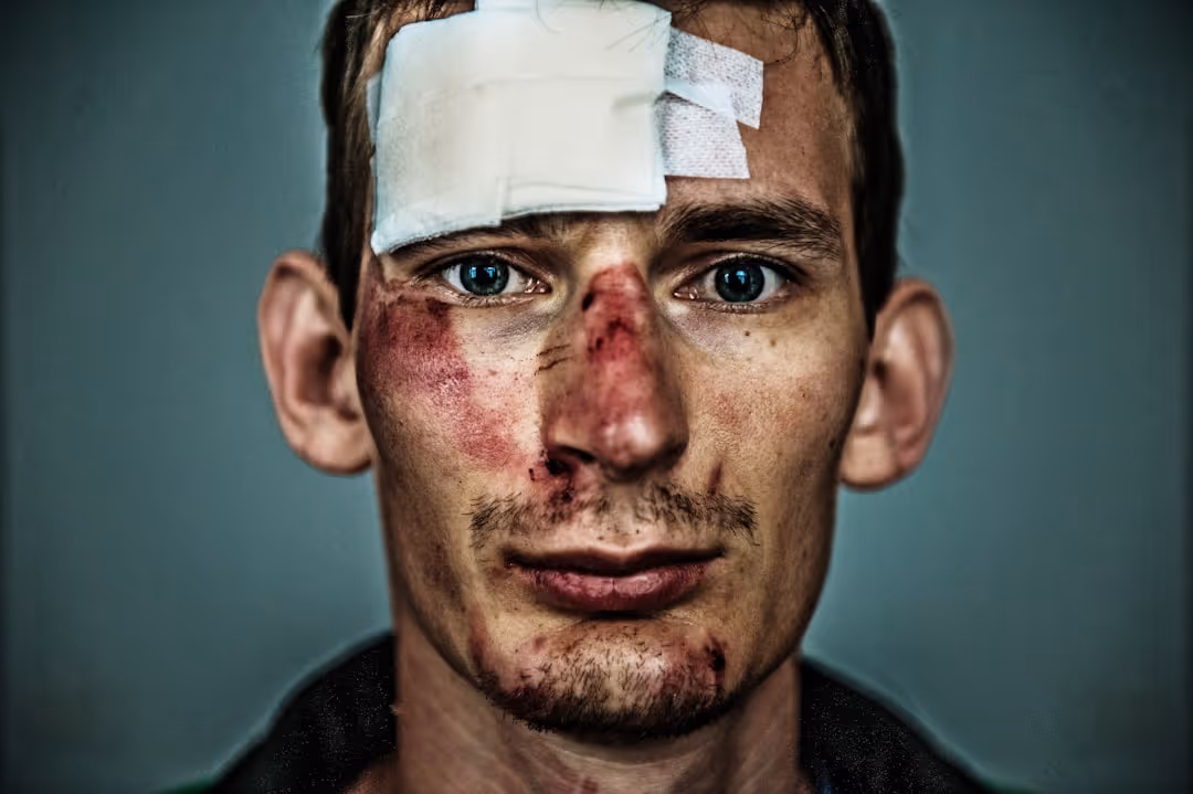 Personal Injury Lawsuits Involving Head Injuries with a Brain Bleed