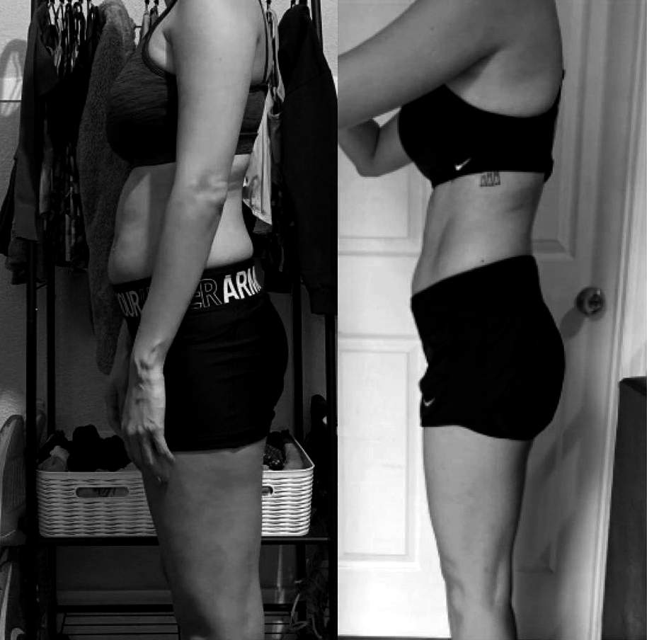 SD evolution before and after