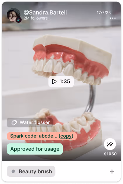 Model of upper and lower teeth displayed on a stand, used for dental demonstration.