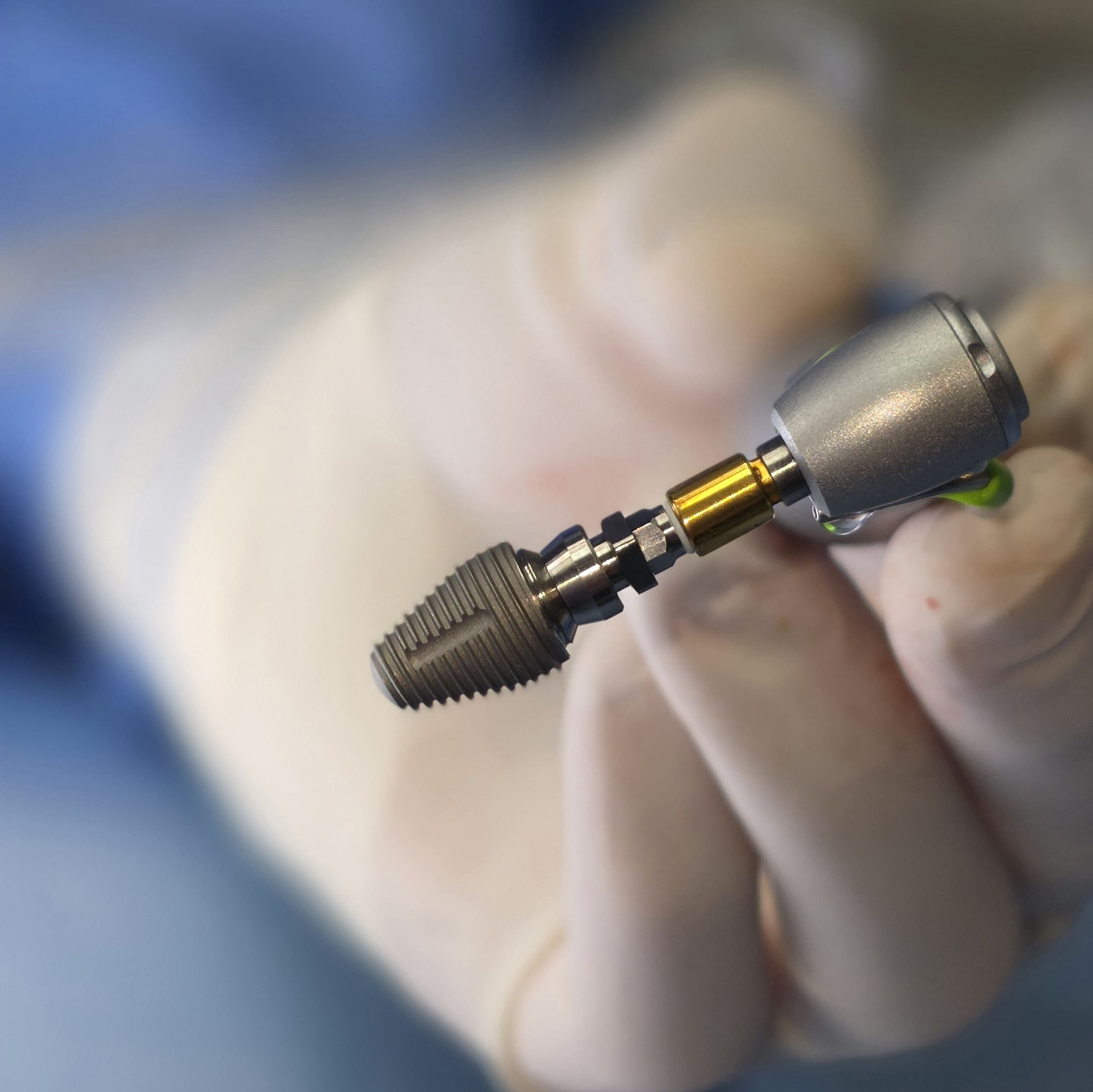 Extraction implantation immédiate avec un implant MAX de Southern Implants