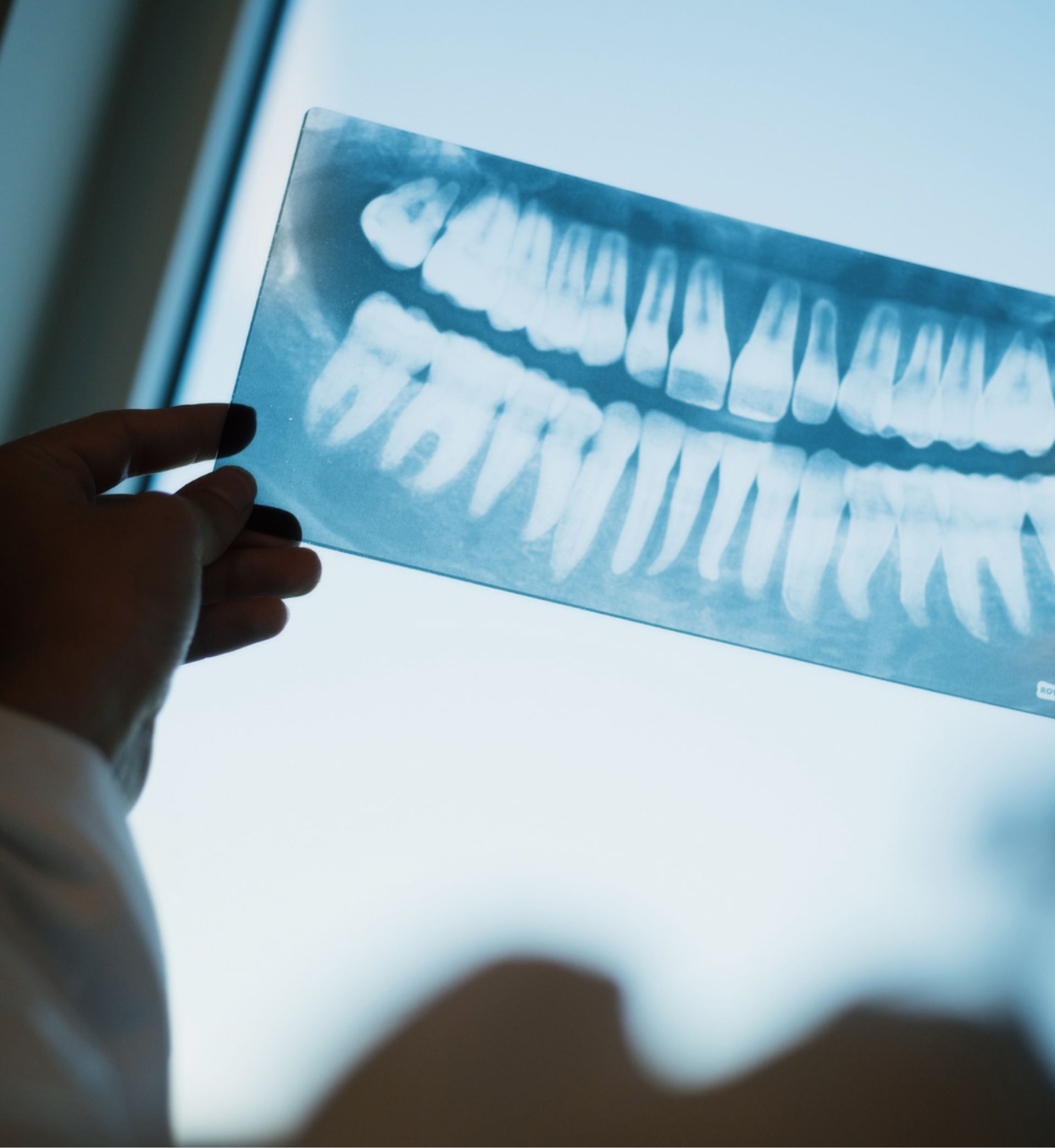 Hand holding a dental X-ray showing upper and lower teeth.