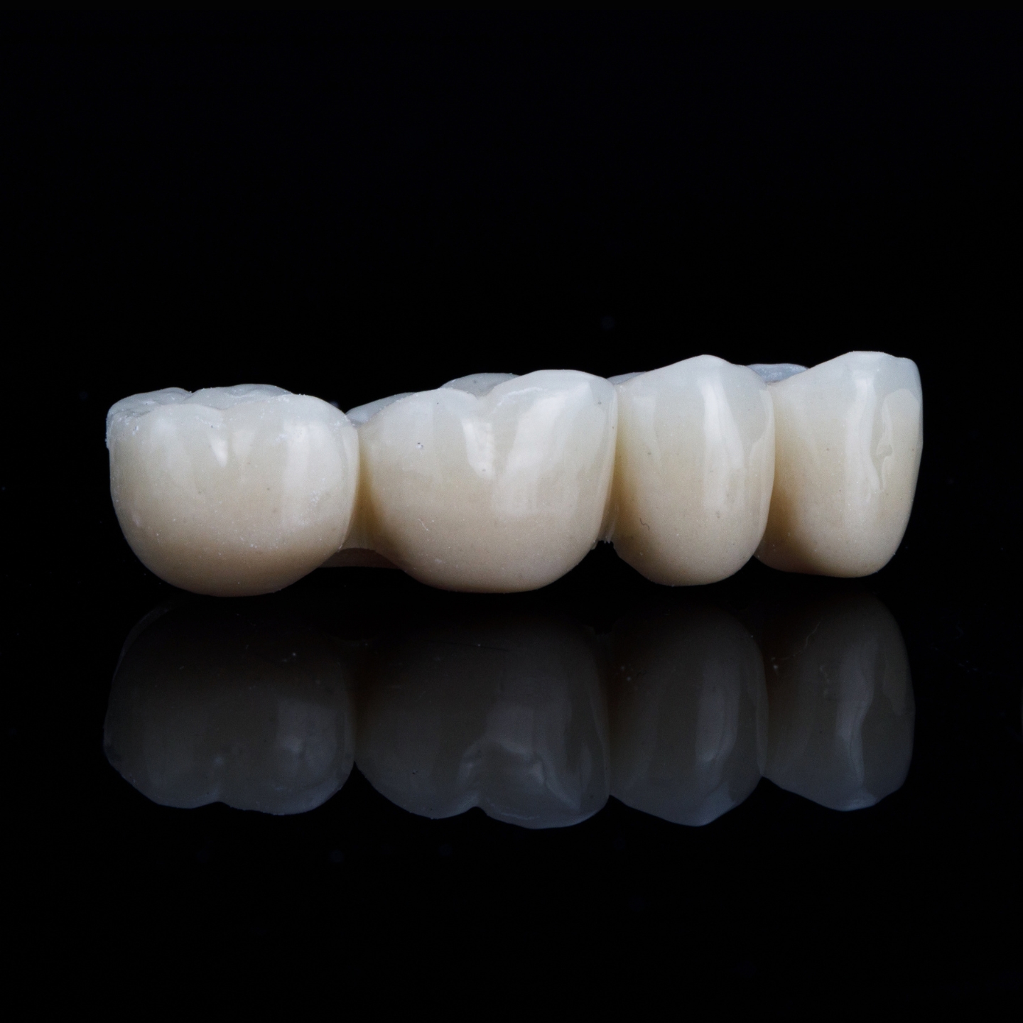 A close-up of a dental bridge restoration showing multiple connected ceramic teeth against a dark background.