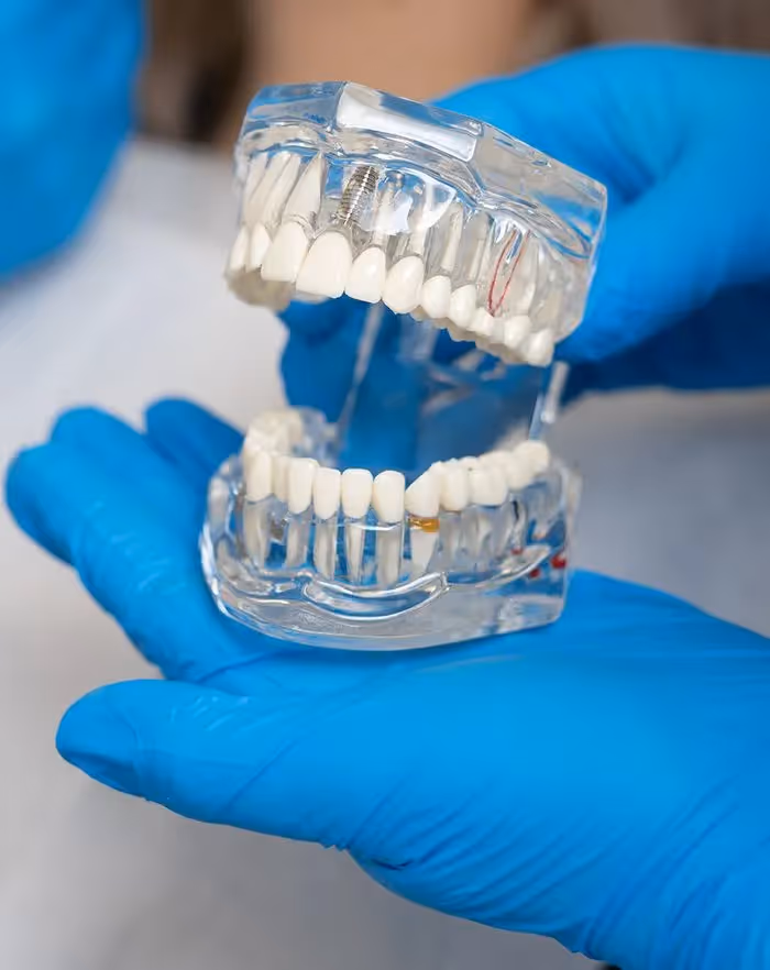 Whole-Health Approach to Implants