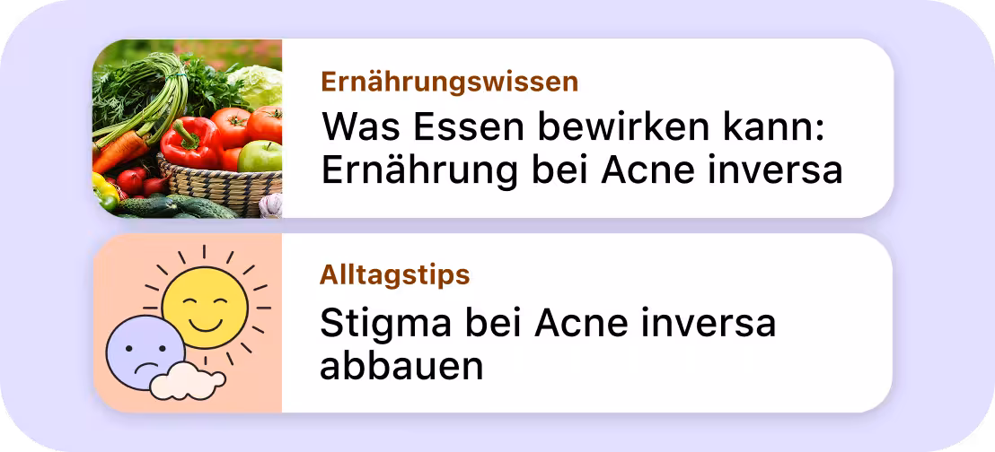 Darstellung von Artikelvorschauen in der MyTherapy App zu Ernährung und Alltagstipps bei Akne Inversa.
