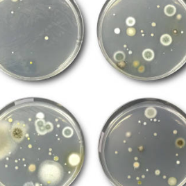 Four petri dishes showing various bacterial and fungal colonies on agar medium.