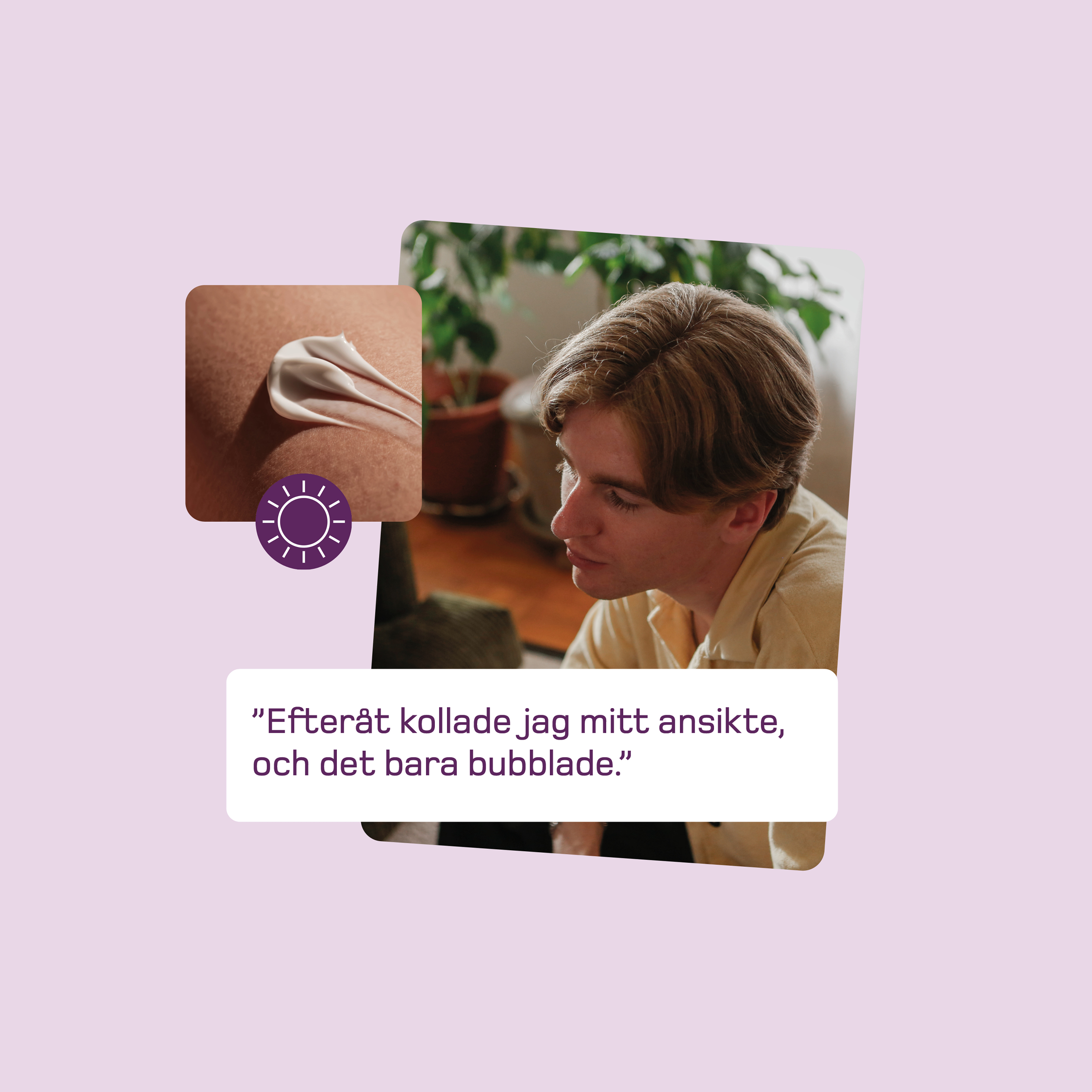 Kollage på ljuslila bakgrund med en man i profil, en bild på kräm med en solikon samt en textruta med citatet: ”Efteråt kollade jag mitt ansikte, och det bara bubblade.”