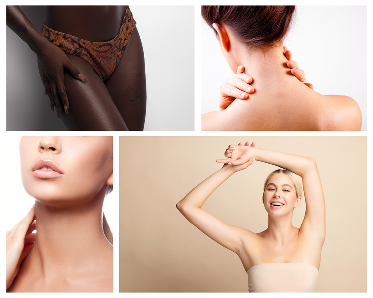 Collage showing diverse women's smooth skin: close-up of dark-skinned woman in patterned bikini bottom touching thigh, back of a woman massaging her neck, close-up of woman's lower face and neck, and smiling blonde woman raising arms against beige background.