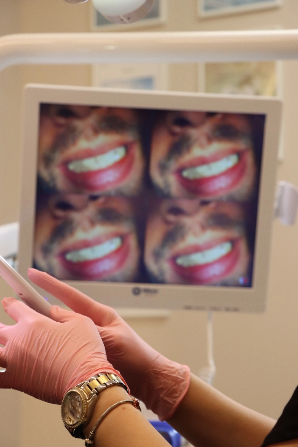 Prosthetic dentistry crowns and bridges Dermiere Aesthetic