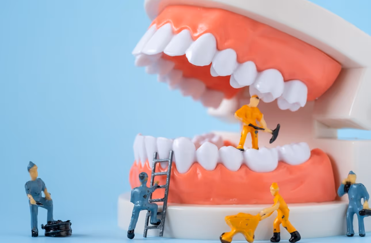Miniature construction workers posed around large model teeth, symbolizing dental repair