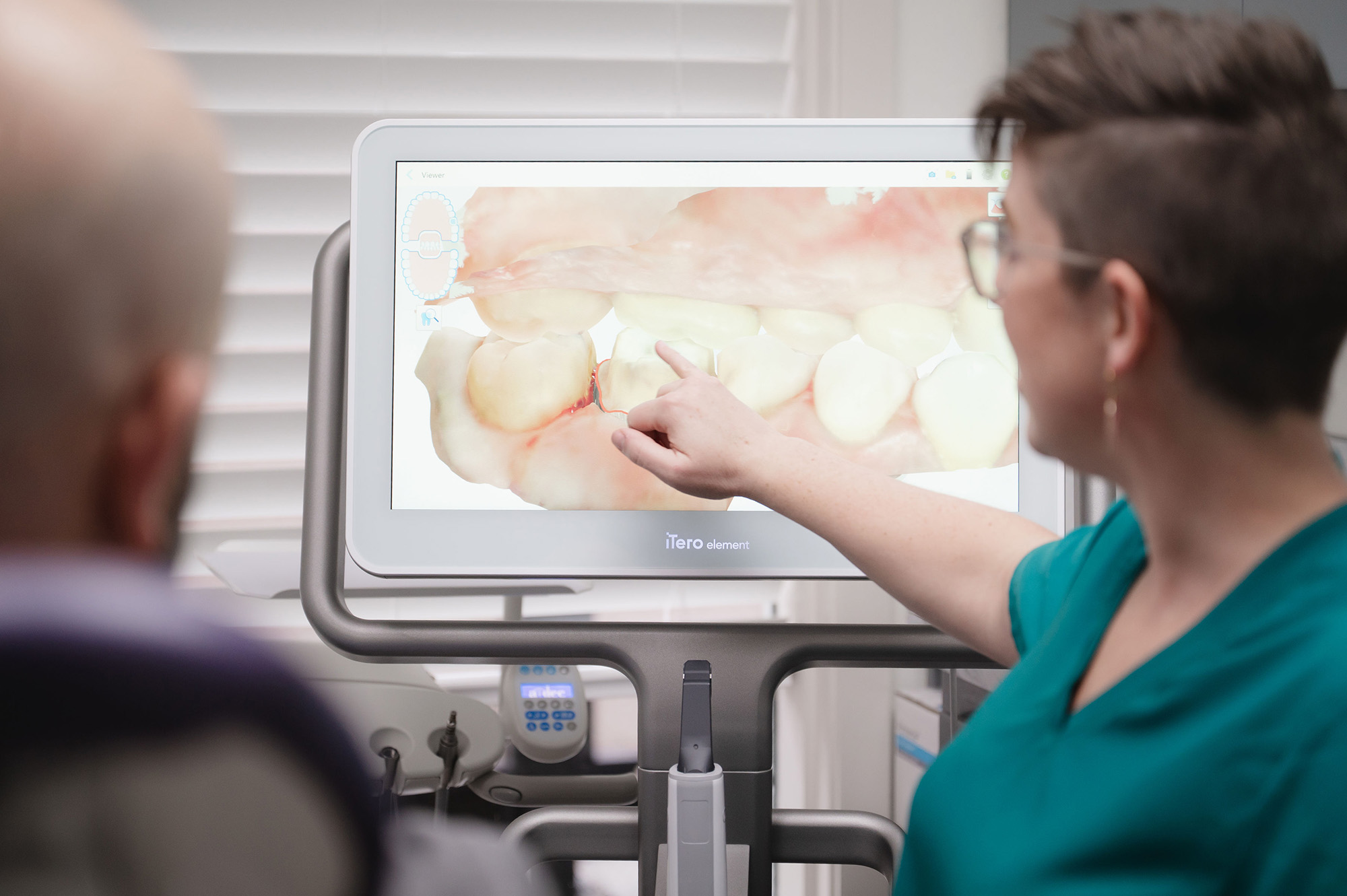 Dental professional pointing at a 3D dental scan of teeth displayed on an iTero Element screen for a patient.