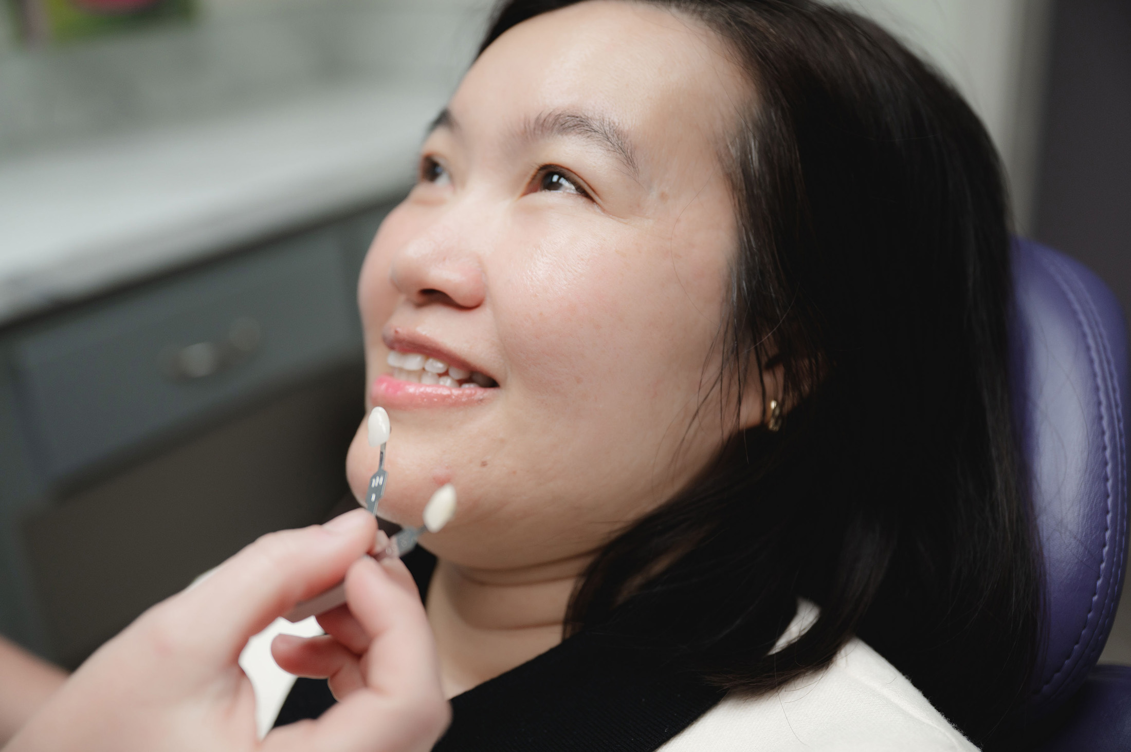 Close-up of a woman smiling in a dental chair while a hand holds two dental shade guides near her mouth.
