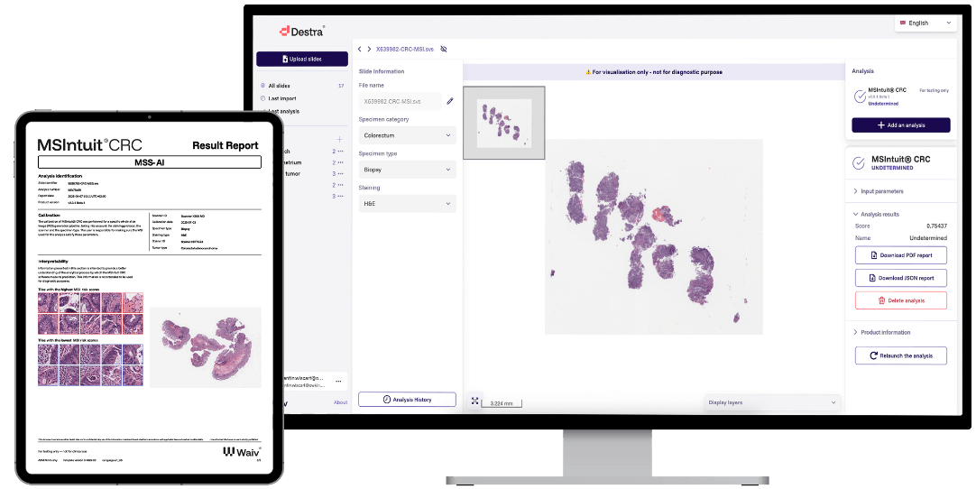MSIntuit: Rule-out MSS cases from the diagnostic workflow by screening with AI for digital pathology